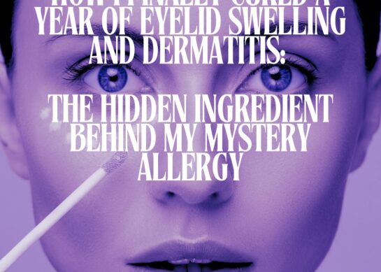 How I Finally Cured a Year of Eyelid Swelling and Dermatitis: The Hidden Ingredient Behind My Mystery Allergy