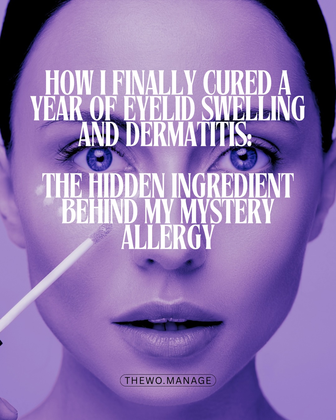 How I Finally Cured a Year of Eyelid Swelling and Dermatitis: The Hidden Ingredient Behind My Mystery Allergy